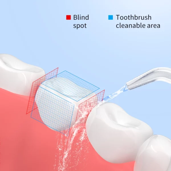 Water flosser dental irrigator